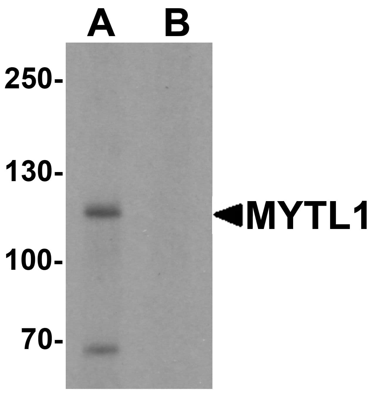 MYT1L Antibody
