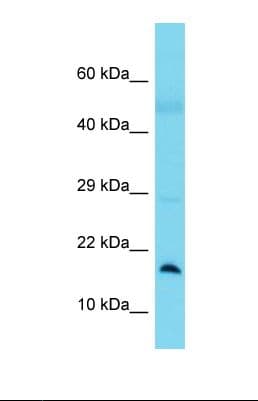 Polyclonal Rabbit anti-Human BLOC1S1 Antibody (aa22-71, WB)