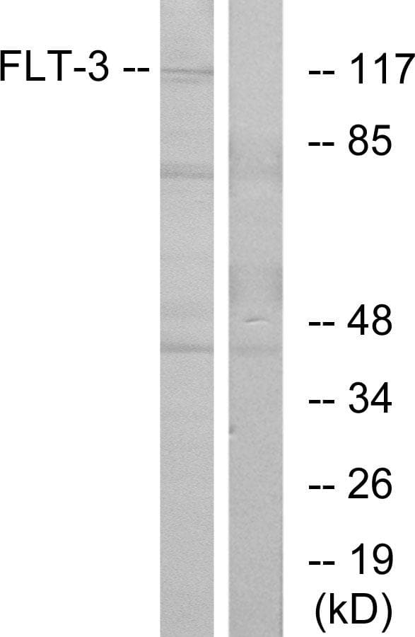 Polyclonal Rabbit anti-Human CD135 / FLT3 Antibody (p599, WB)