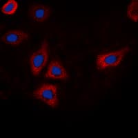 EGFR Antibody (phospho-Thr693)