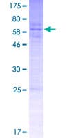 Human SPY1 / SPDYA Protein (Recombinant GST)