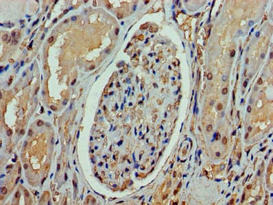 ASH2L / ASH2 Antibody (aa1-534)