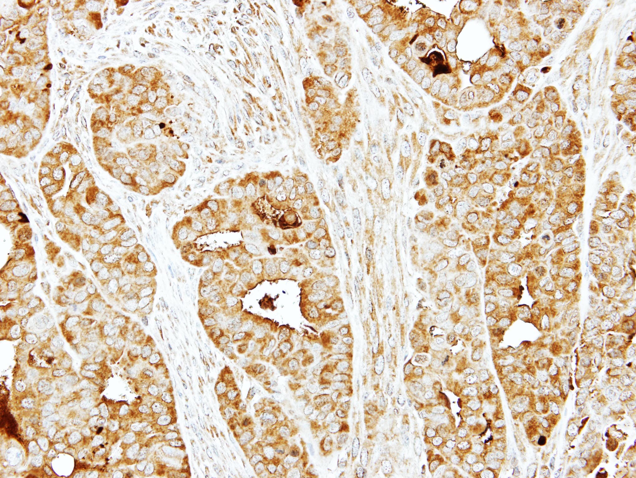 Polyclonal Rabbit anti-Human BBS10 Antibody (aa182-443, IHC, WB)
