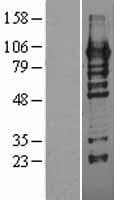 Human HDGFRP2 Protein (Over-Expression Lysate Myc-DDK (Flag))