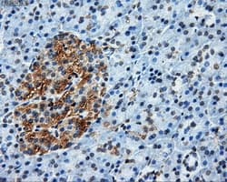 ATP5B / ATP Synthase Beta Antibody (clone OTI6C4)