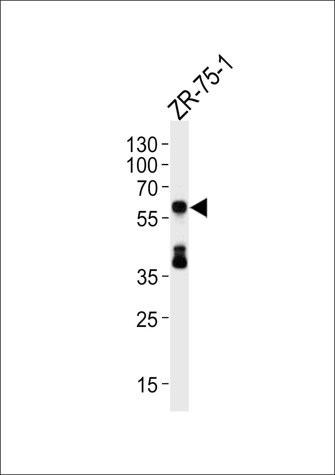 IHC-plus™ Delta3 / DLL3 Antibody (aa519-548)