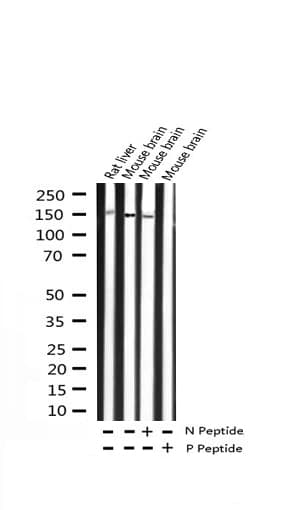 Polyclonal Rabbit anti-Human NTRK2 / TRKB Antibody (phospho-Tyr515, IHC, IF, WB)