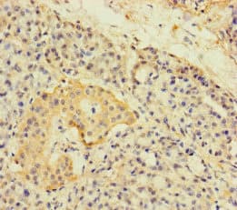 Polyclonal Rabbit anti-Human Alpha4GnT / A4GNT Antibody