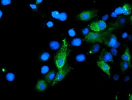 SENP2 Antibody (clone OTI3D12)