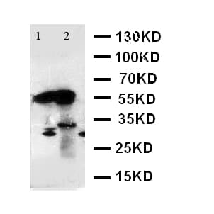 AMY1A / Salivary Amylase Antibody (aa30-44)