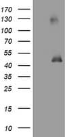 MAGEA3 Antibody (clone OTI24B6)