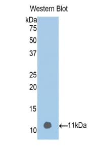 GC / Vitamin D-Binding Protein Antibody (aa395-473)