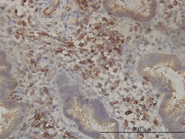 PANK2 Antibody (clone 2B12)