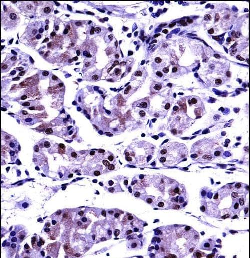PP2CB / PPP2CB Antibody (aa278-307)
