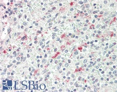 IHC-plus™ NCR3LG1 / B7H6 Antibody (aa389-415)