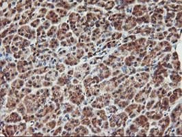 KCNAB1 Antibody (clone OTI7C7)
