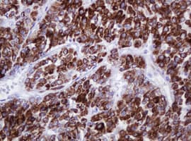 AMACR / P504S Antibody (clone OTI5F10)