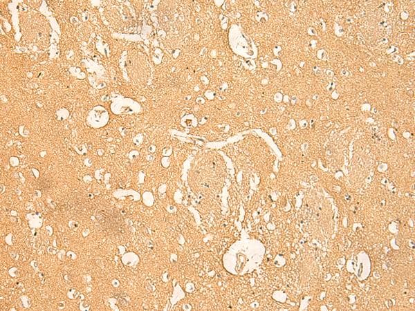 Polyclonal Rabbit anti-Human RNASE4 Antibody (IHC)