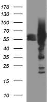 TH / Tyrosine Hydroxylase Antibody (clone OTI1A12)