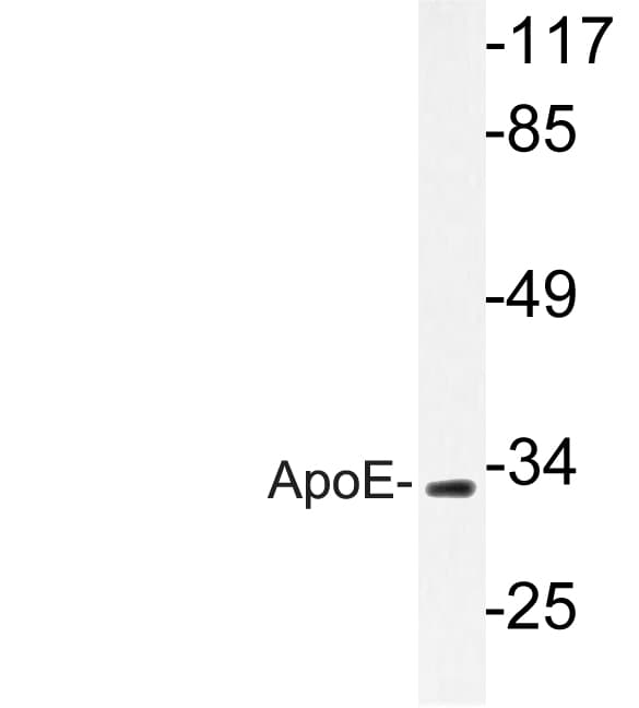 APOE / Apolipoprotein E Antibody (Met86)
