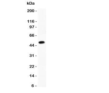 Polyclonal Rabbit anti-Human CMA1 / Mast Cell Chymase Antibody (aa22-247, IHC, WB)