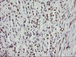 TLE1 / TLE 1 Antibody (aa180-460, clone OTI1F5)