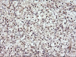MAP2K3 / MEK3 / MKK3 Antibody (clone OTI5G5)