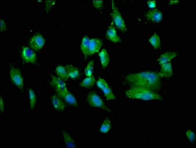 Polyclonal Rabbit anti-Human TNFSF12 / TWEAK Antibody (IHC, WB)