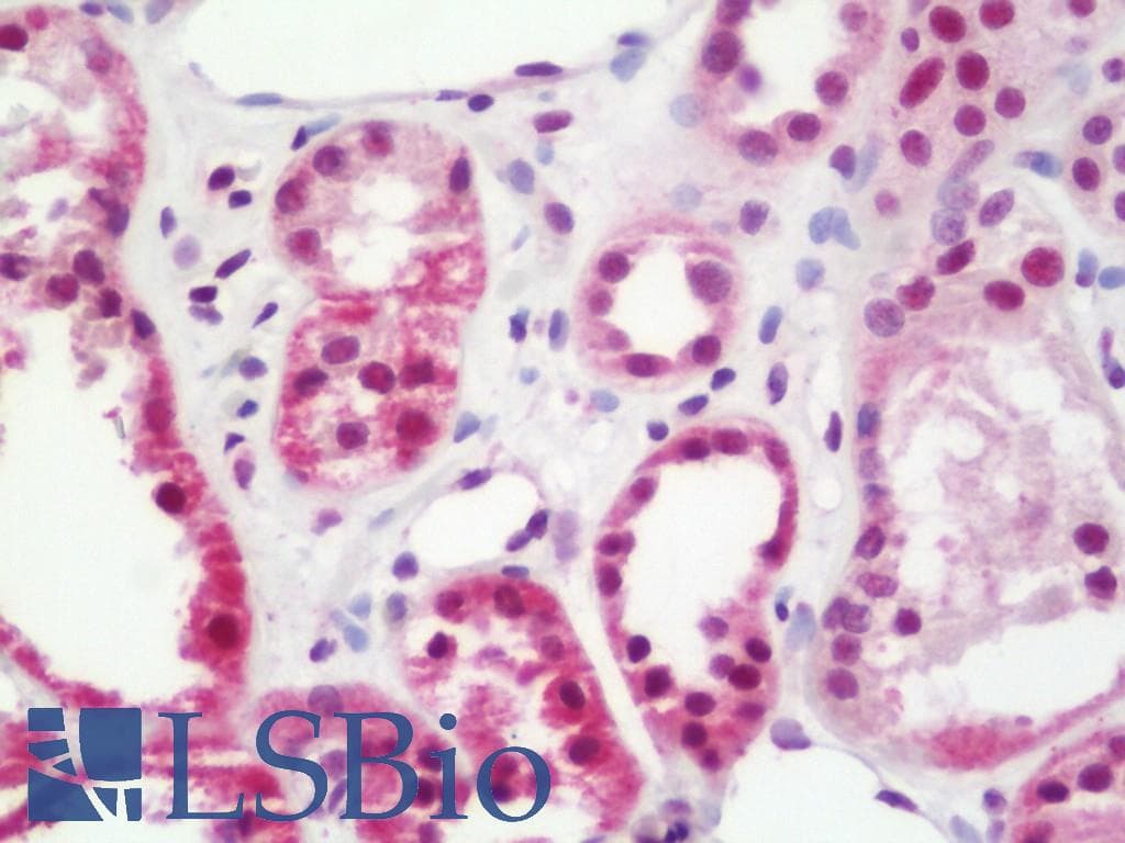 IHC-plus™ TRIM33 / TIF1-Gamma Antibody (aa1077-C-term)