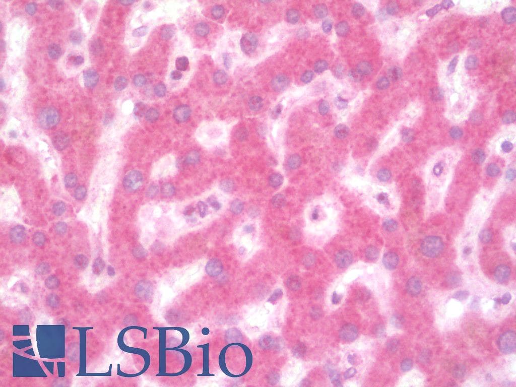 IHC-plus™ Polyclonal Rabbit anti-Human ULK1 Antibody (IHC, IF, WB)