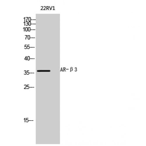 ADRB3 Antibody (220-300 aa, Internal)