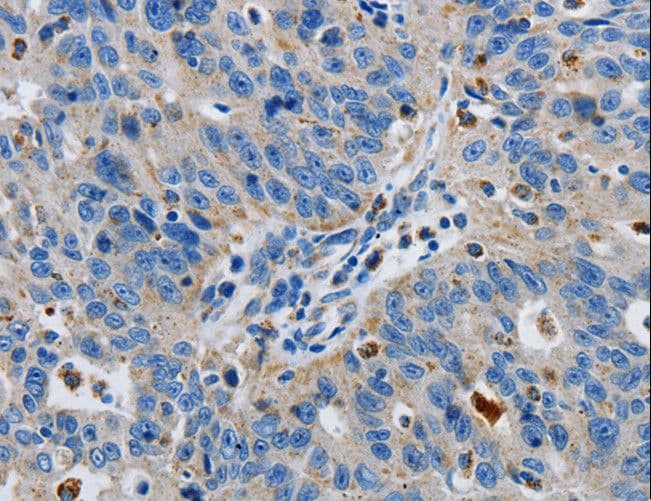 GRIA3 / GLUR3 Antibody