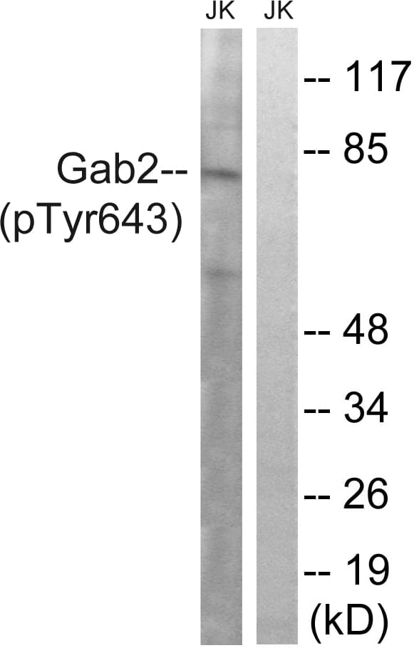 Polyclonal Rabbit anti-Human GAB2 Antibody (phospho-Tyr643, IHC, WB)