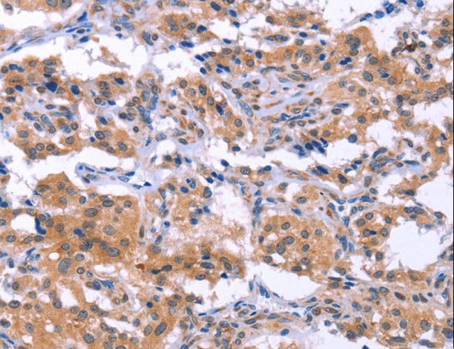 ESPL1 / Separase Antibody