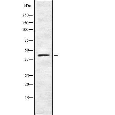 NR2E1 / TLX Antibody
