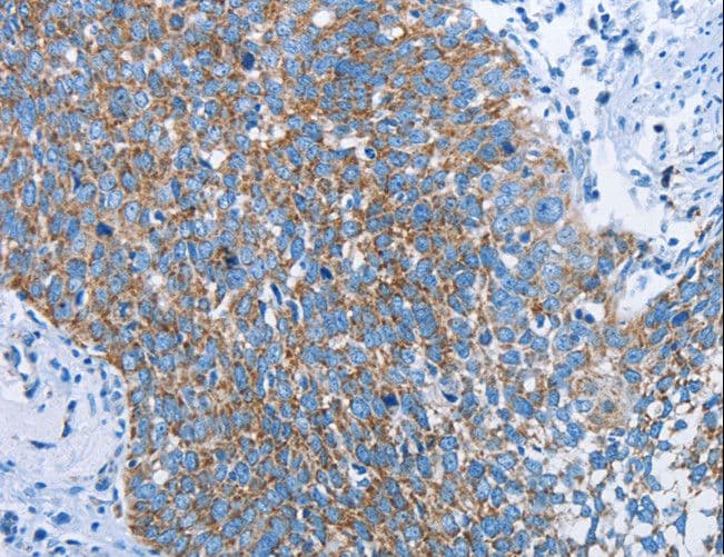 HINT2 Antibody