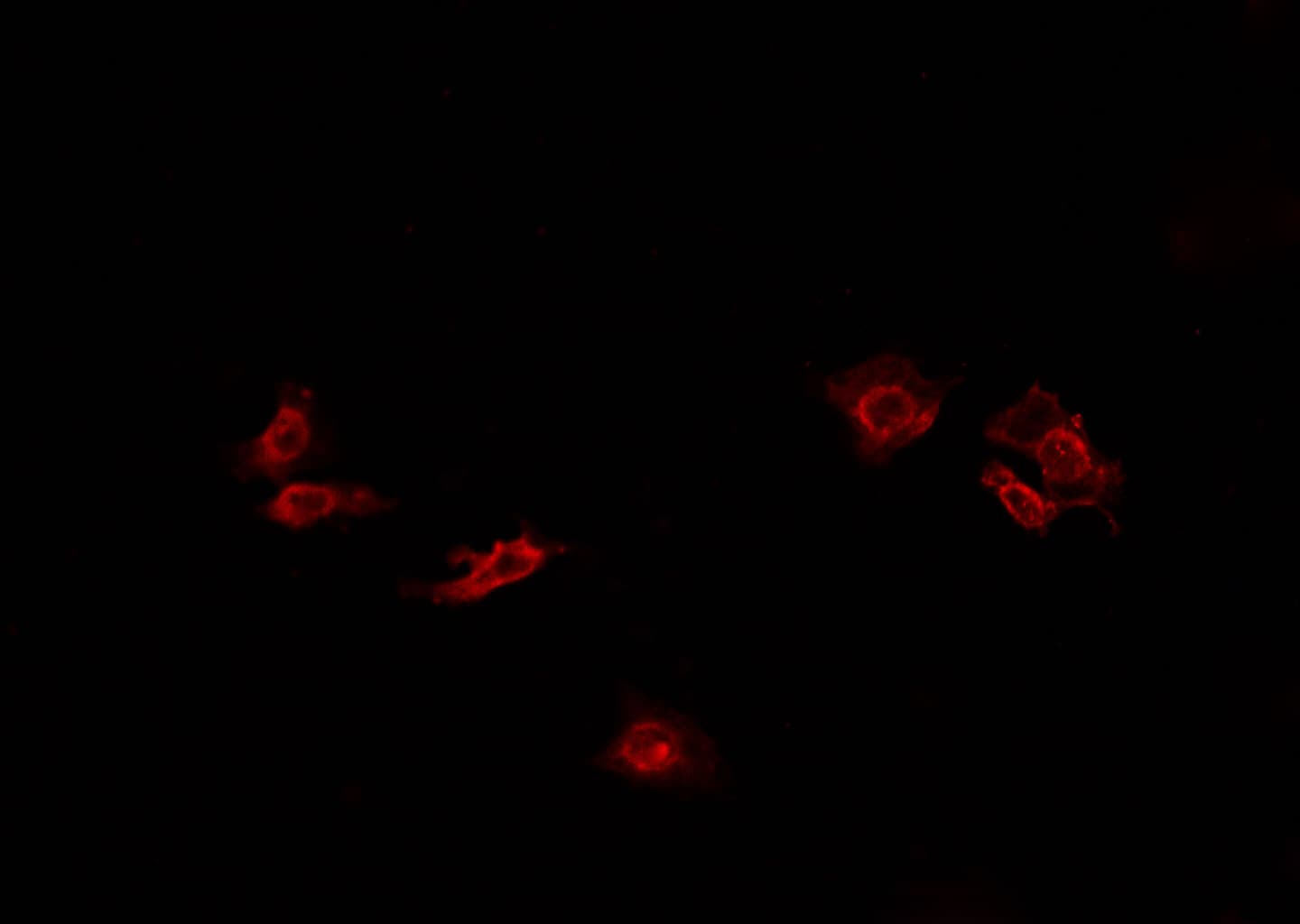 Polyclonal Rabbit anti-Human ATP1A1 Antibody (IHC, IF, WB)