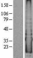 CYYR1 Protein (Over-Expression Lysate Myc-DDK (Flag))