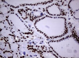 NBN / Nibrin Antibody (clone OTI1F11)