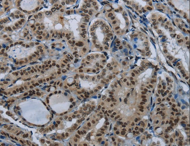 NBL1 / DAN Antibody
