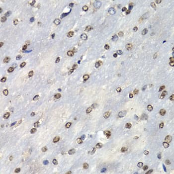 Polyclonal Rabbit anti-Human PSMB10 Antibody (IHC, IF, WB)