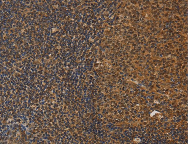 DAB2 Antibody