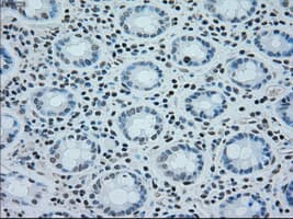 Monoclonal Mouse anti-Human BRAF / B-Raf Antibody (clone OTI1G6, IHC, WB)
