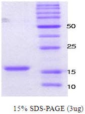 Human SNCA / Alpha-Synuclein Protein (Recombinant)