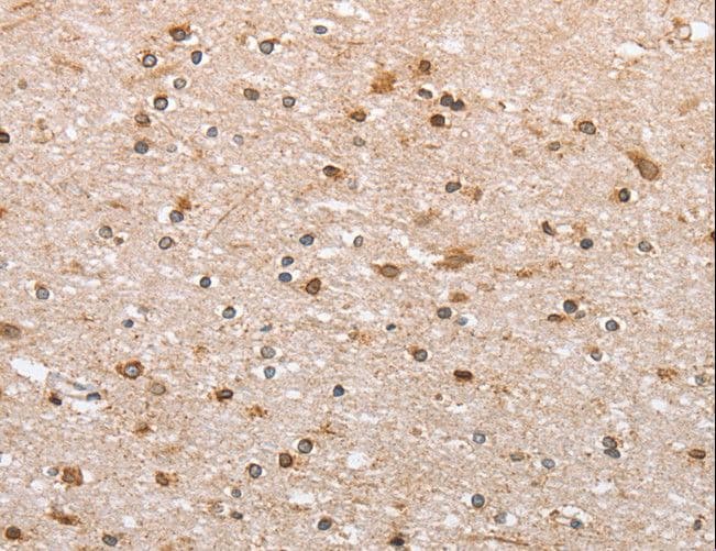 CANX / Calnexin Antibody