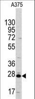 CLIC1 / NCC27 Antibody