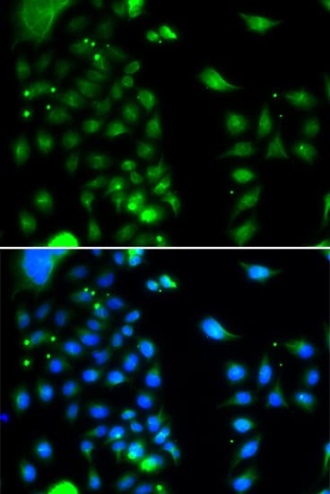 UBC6 / UBE2J2 Antibody