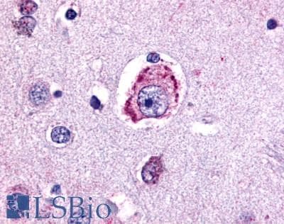 IHC-plus™ Polyclonal Rabbit anti-Human MC4R / Melanocortin 4 Receptor Antibody (N-Terminus, IHC)