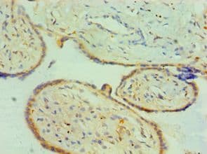 Polyclonal Rabbit anti-Human CTSK / Cathepsin K Antibody (aa115-329, IHC, WB)
