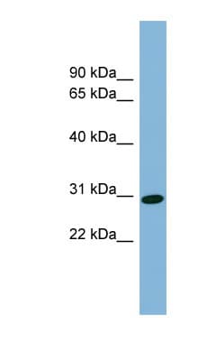 CENPQ Antibody (aa35-84)